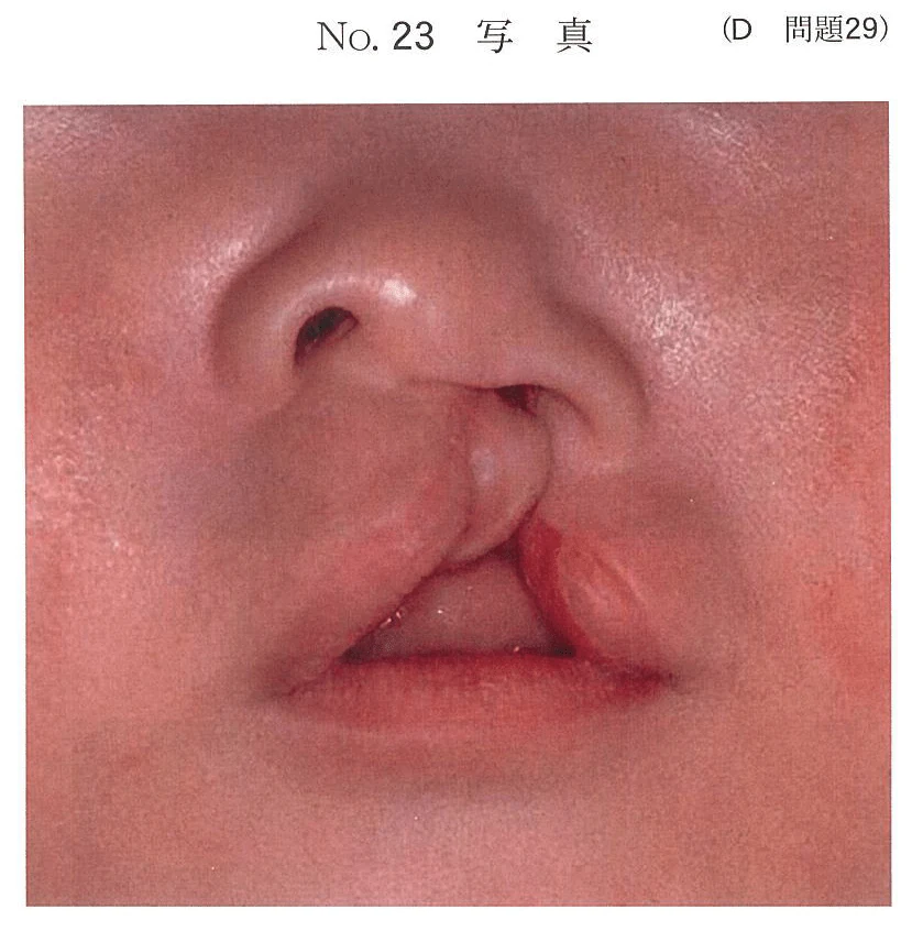 100D29の別冊図1