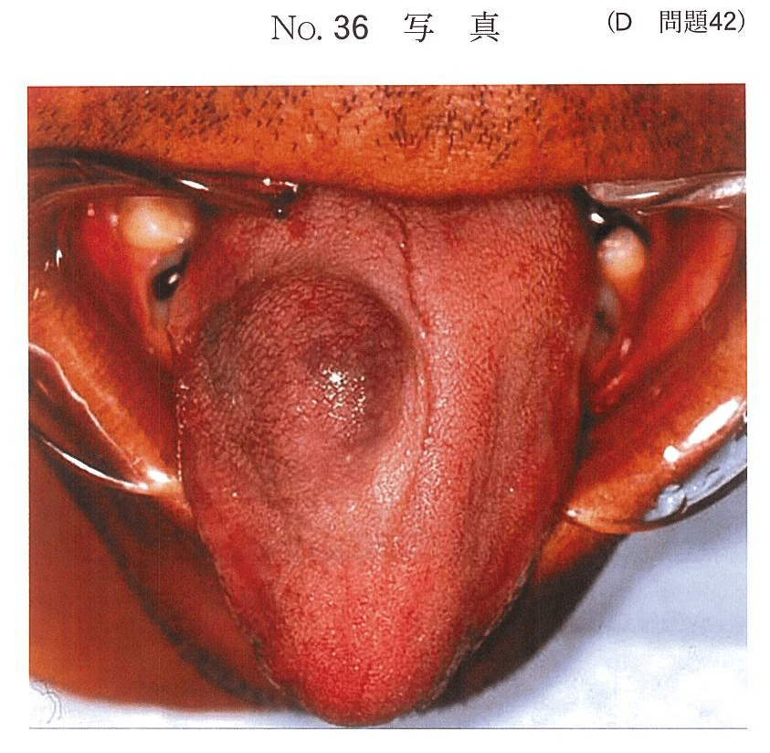 100D42の別冊図1