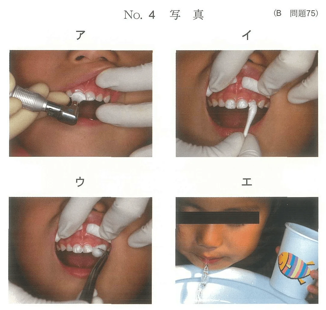 101B75の別冊図1