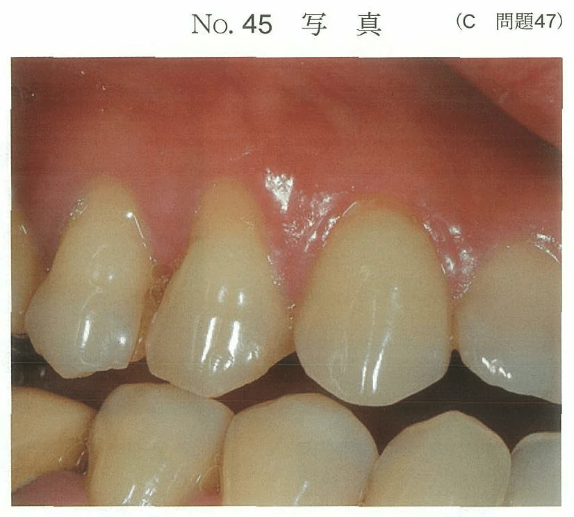 101C47の別冊図1