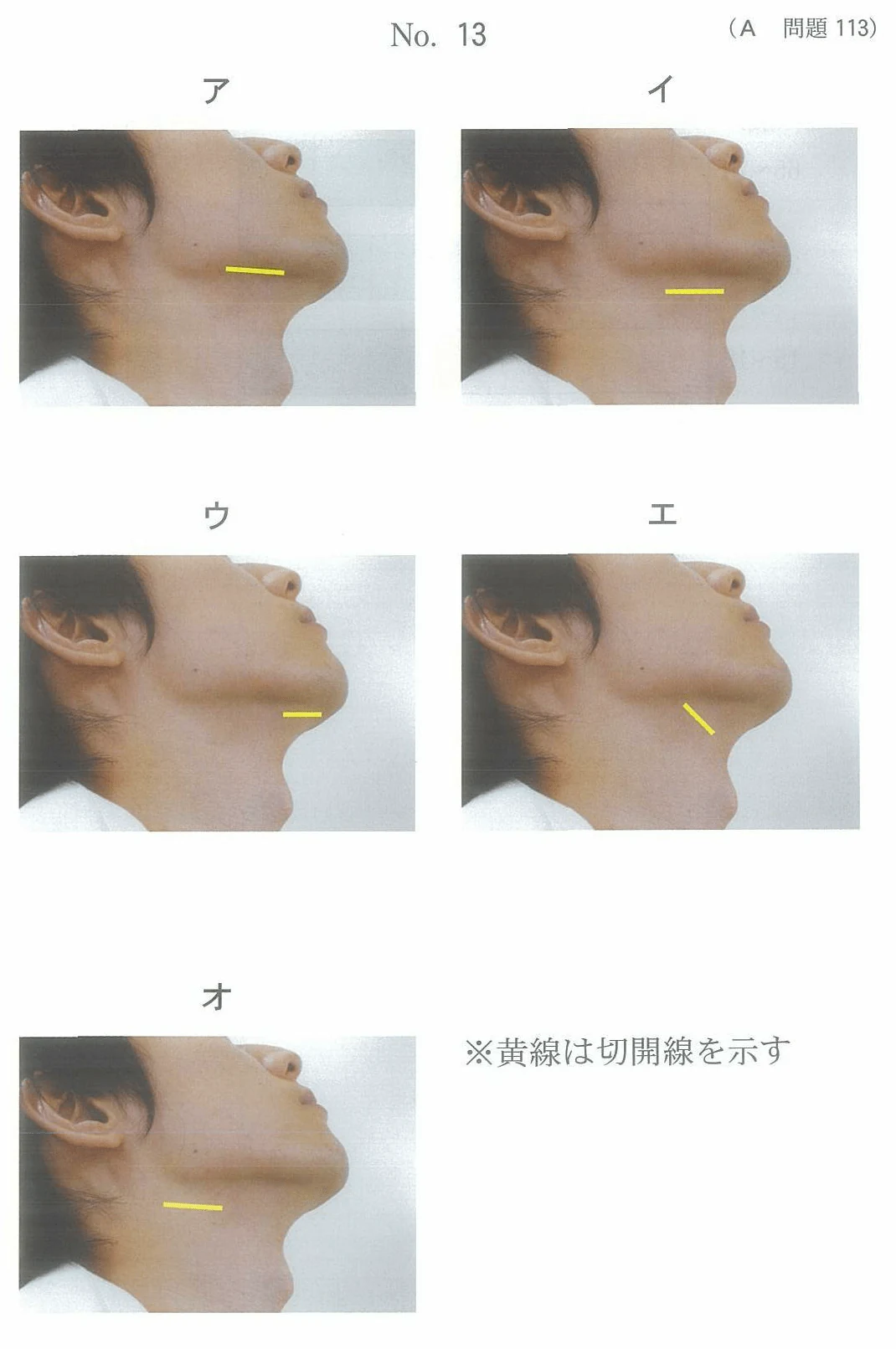 102A113の別冊図1