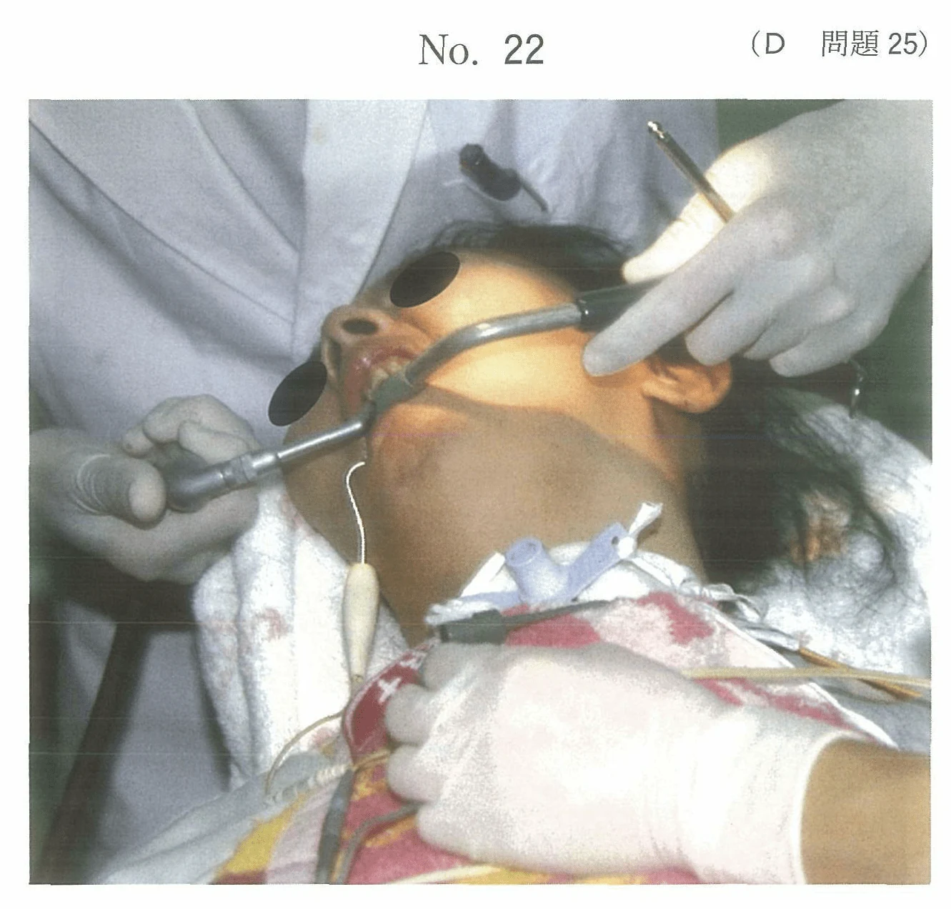 102D25の別冊図1