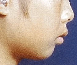 103B44の別冊図1