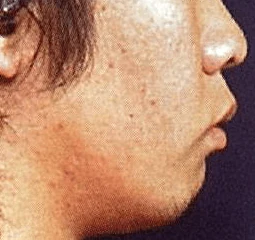 103D10の別冊図4
