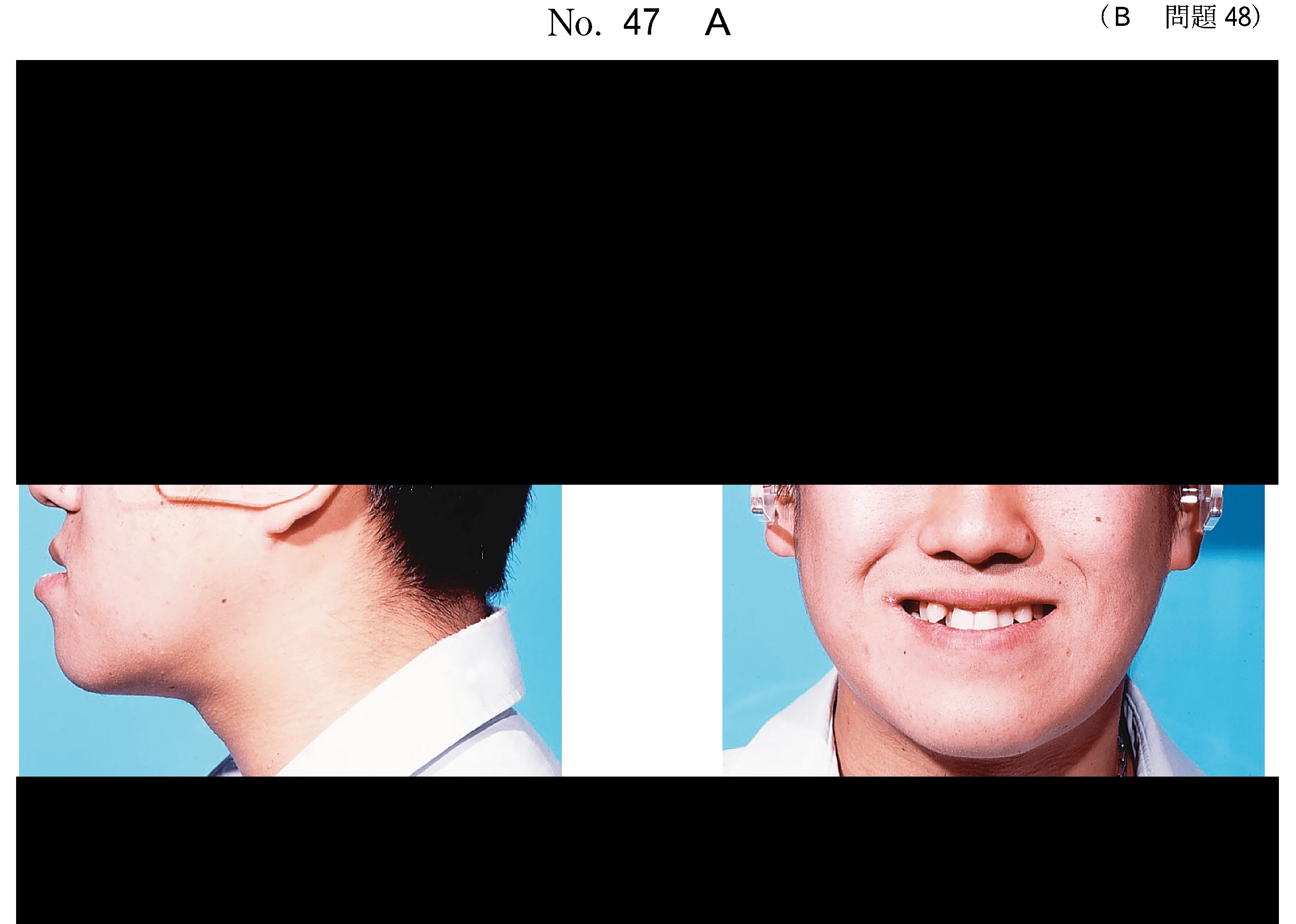 104B48の別冊図2