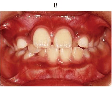 105B29の別冊図2