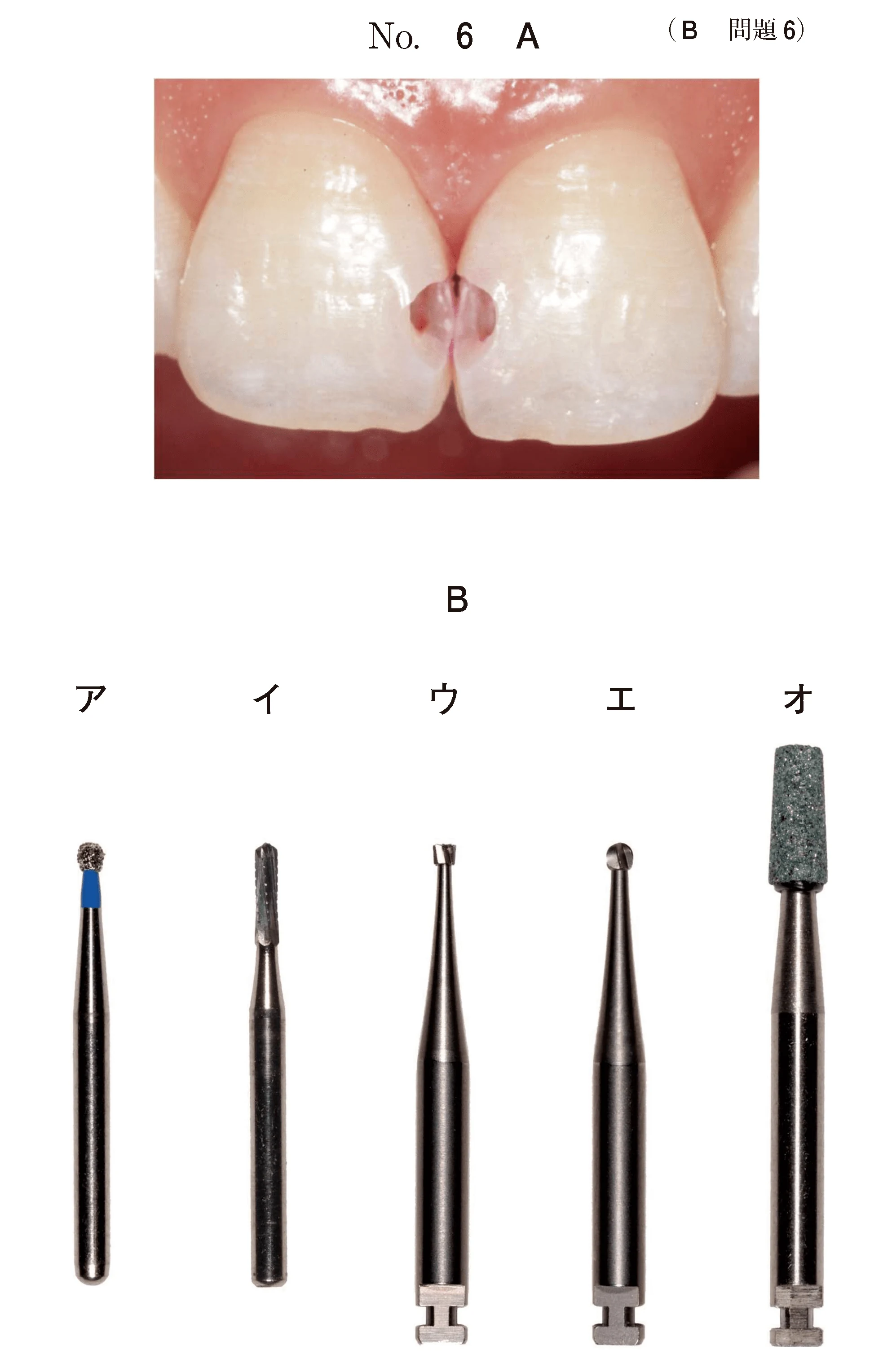 105B6の別冊図1
