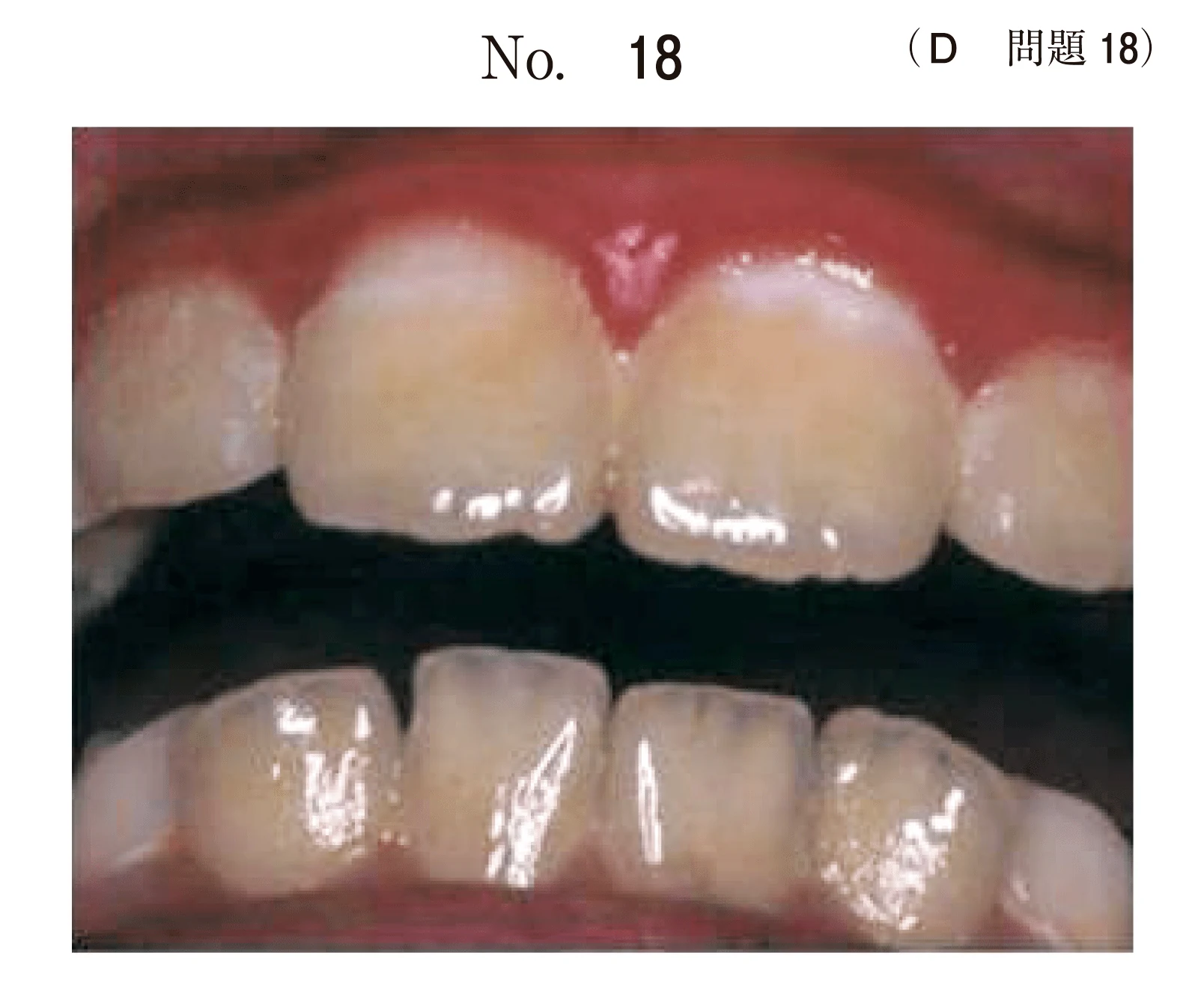 106D18の別冊図1