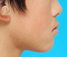 107B32の別冊図2