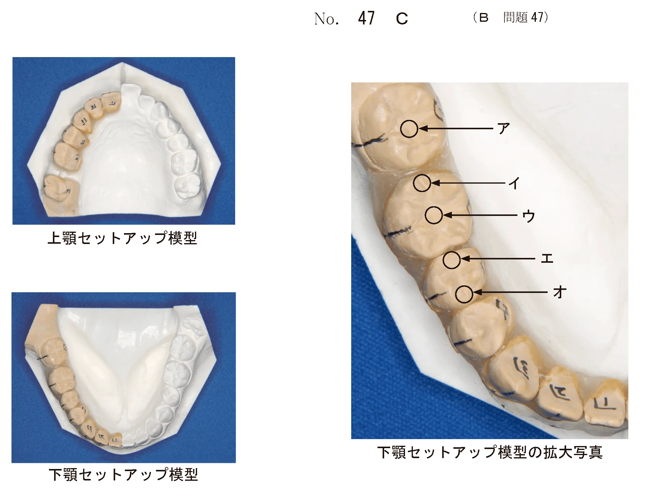 107B47の別冊図4
