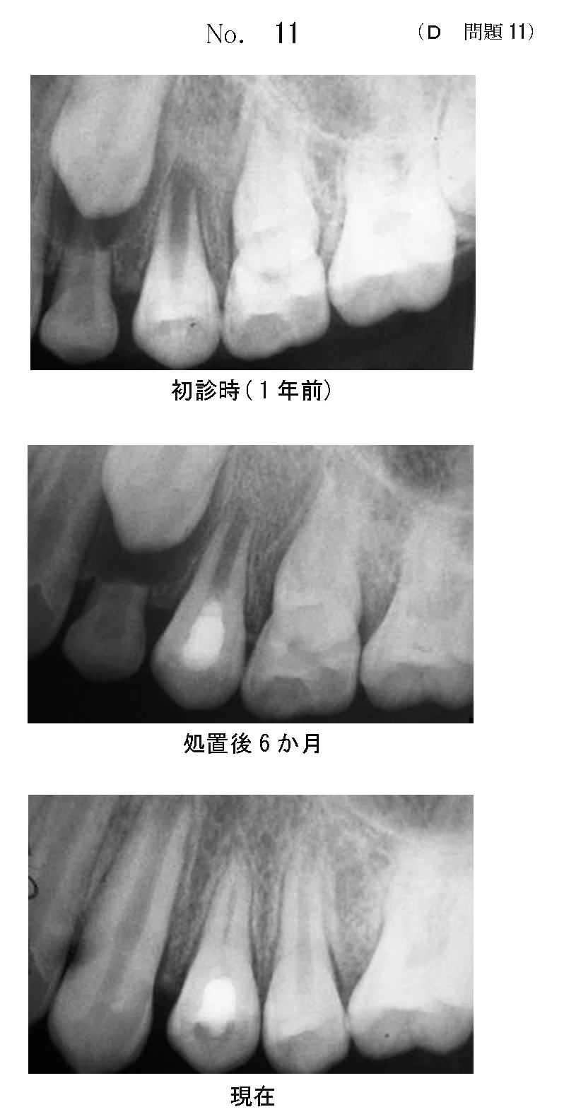 107D11の別冊図1