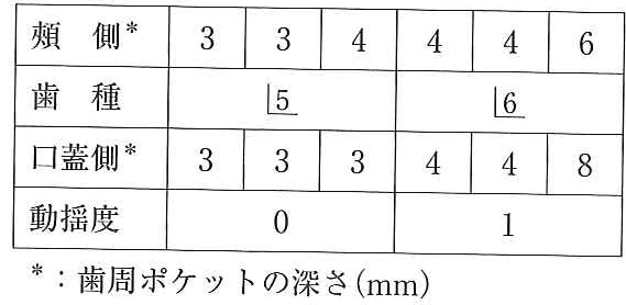 108B18の別冊図1
