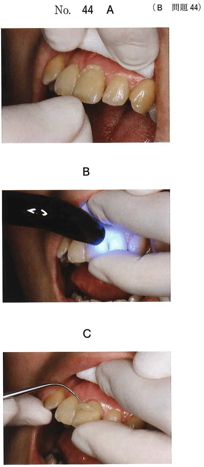 108B44の別冊図1