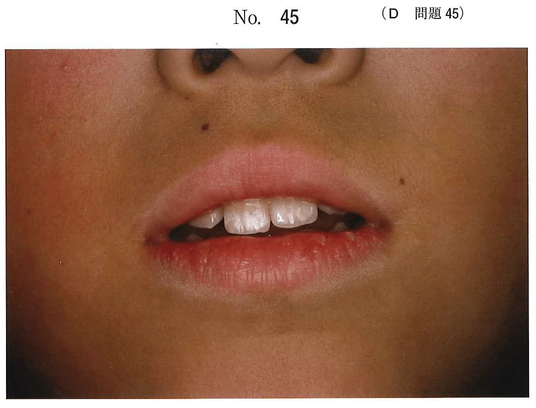 108D45の別冊図1