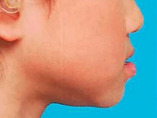 109B11の別冊図2