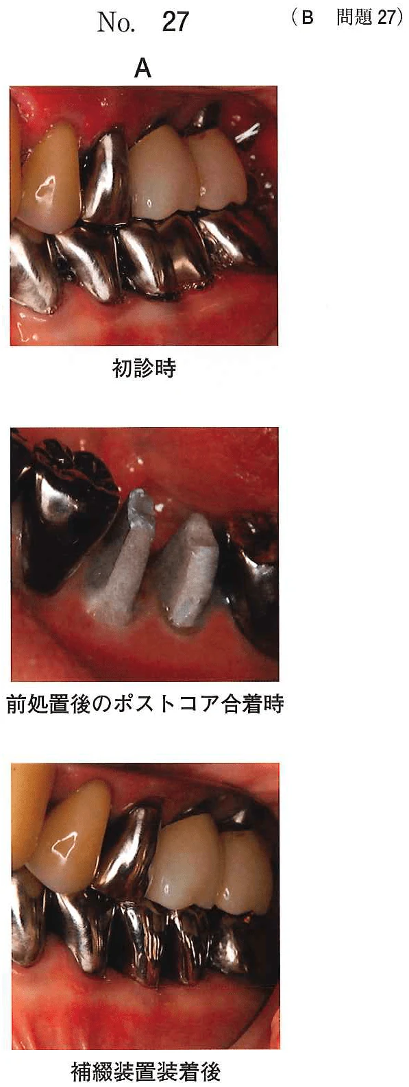 109B27の別冊図1