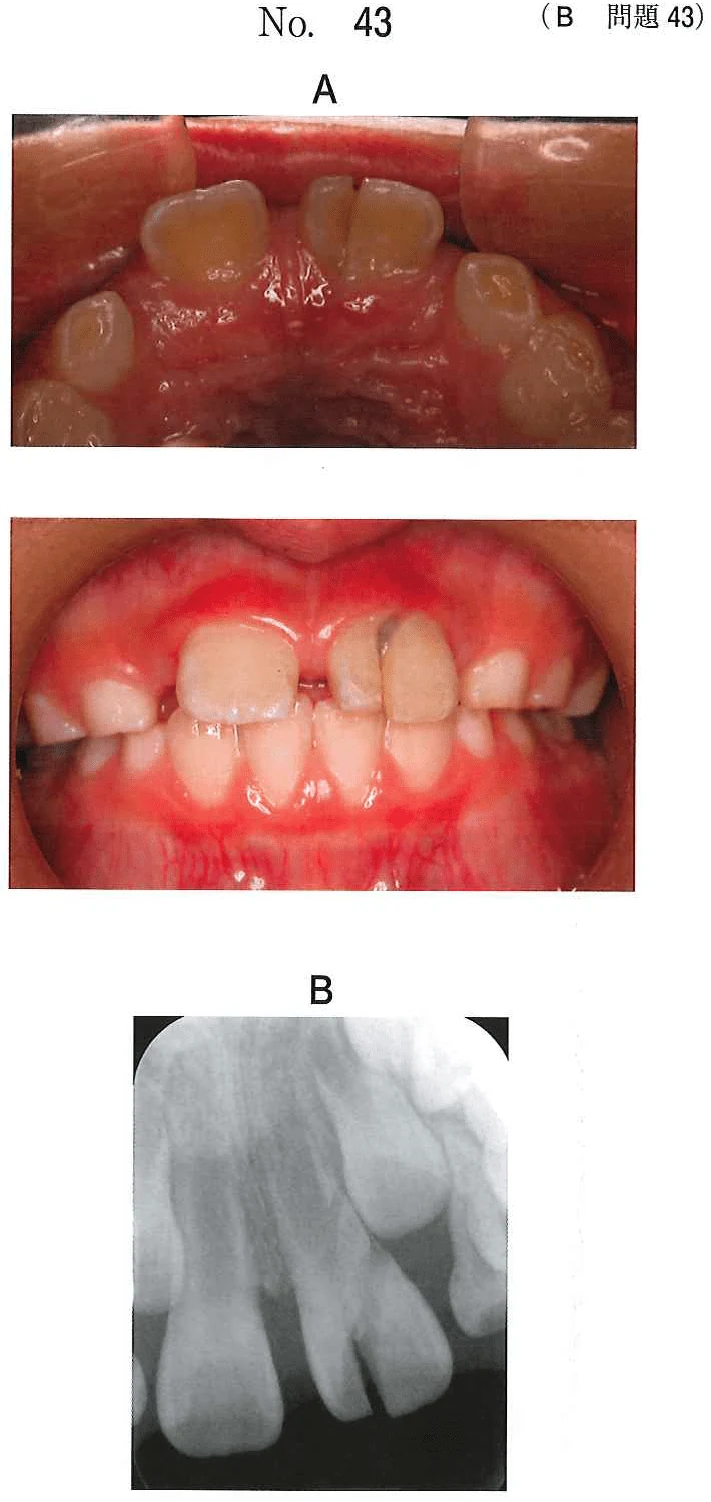 109B43の別冊図1