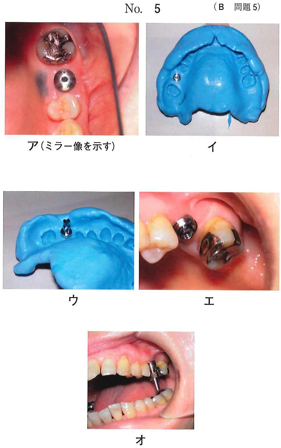 109B5の別冊図1