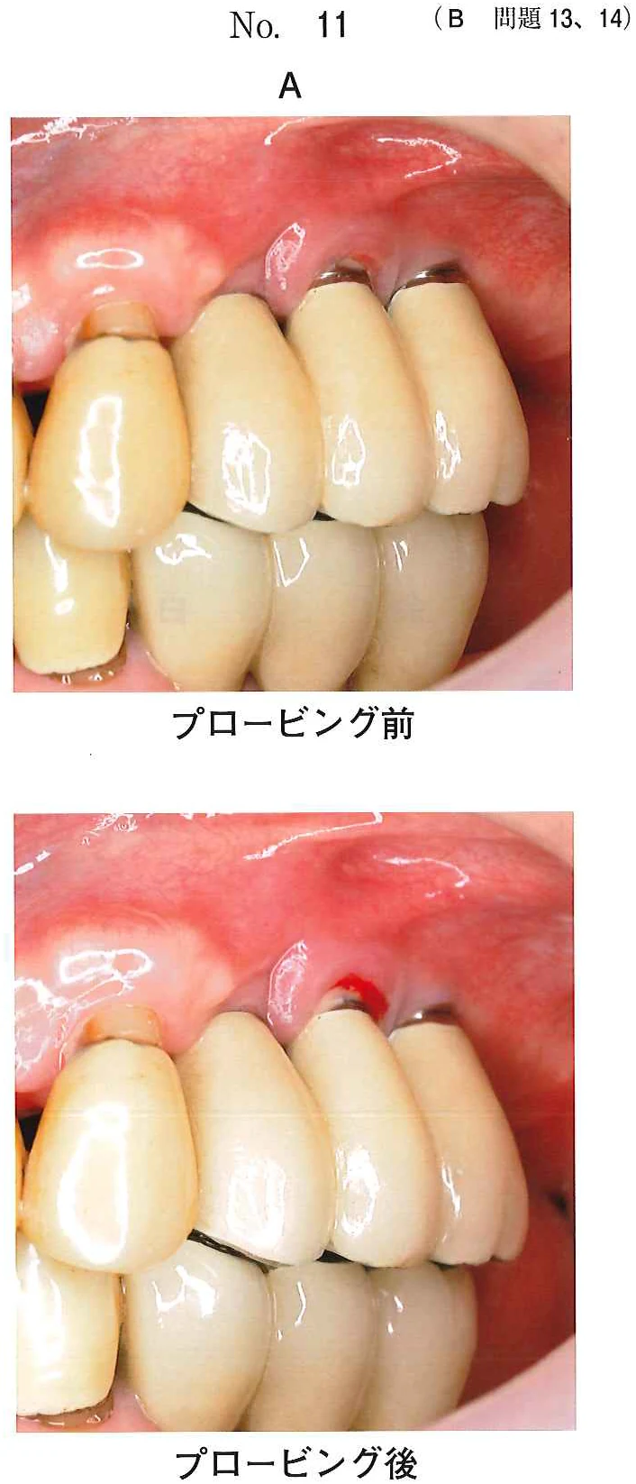 110B13の別冊図1