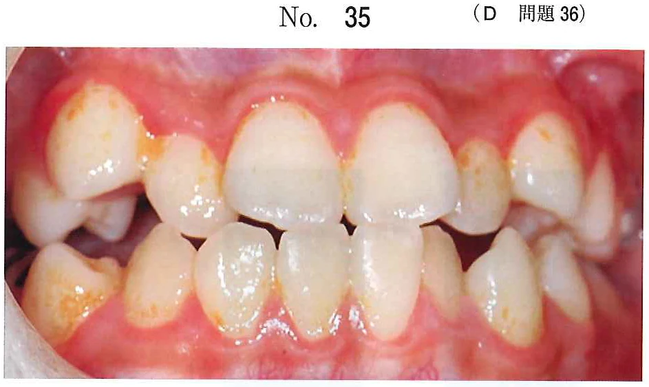 110D36の別冊図1