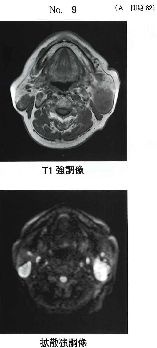 111A62の別冊図1
