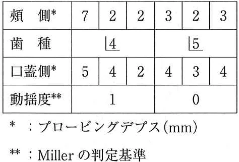111A75の別冊図1