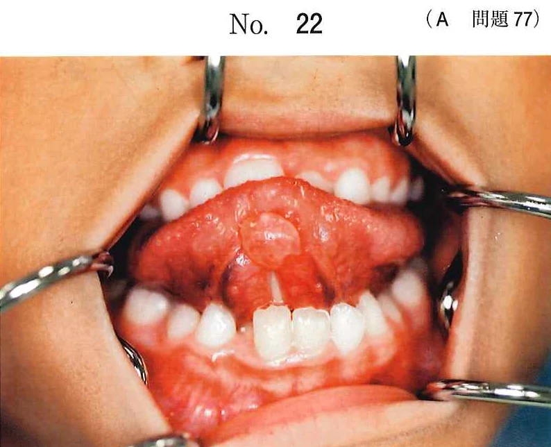 111A77の別冊図1