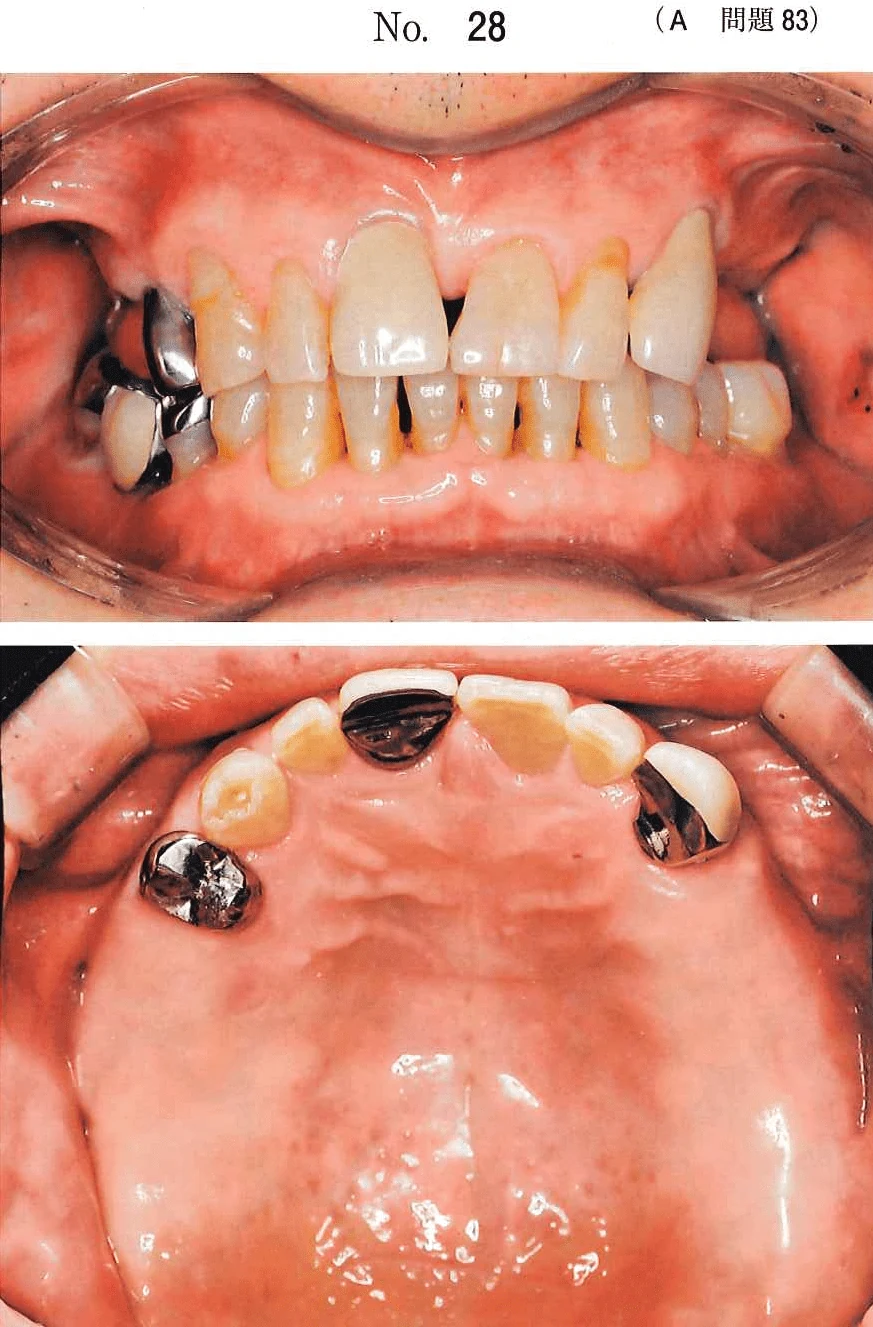111A83の別冊図1