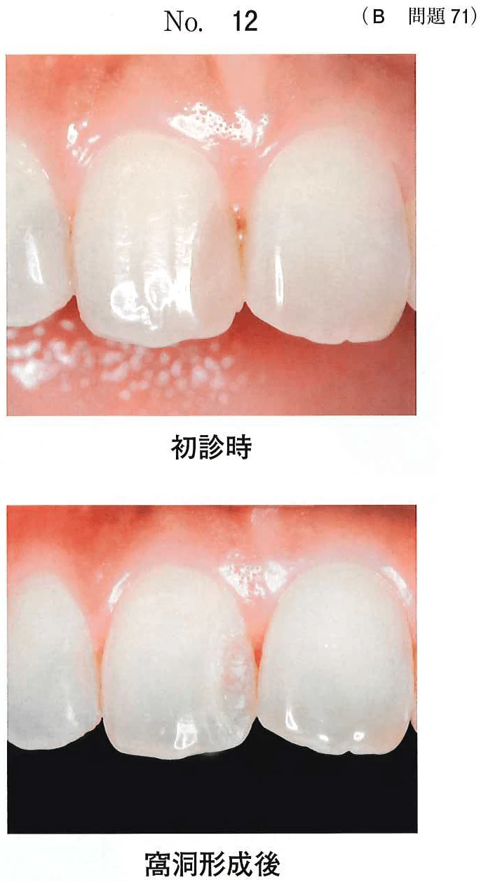 111B71の別冊図1