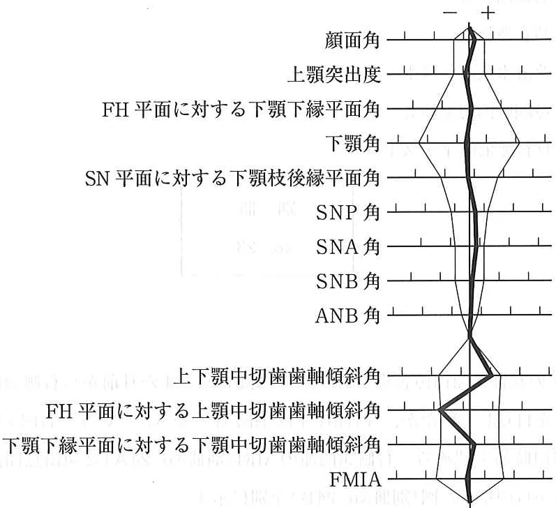 111B85の別冊図1