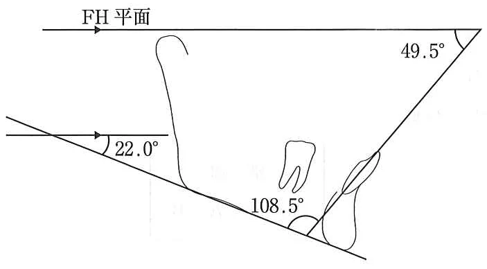 111C62の別冊図1
