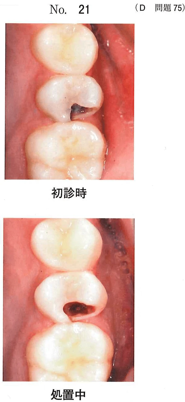 111D75の別冊図1