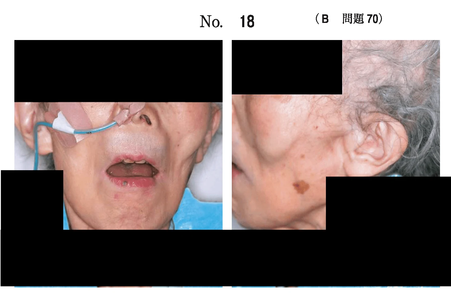 112B70の別冊図1