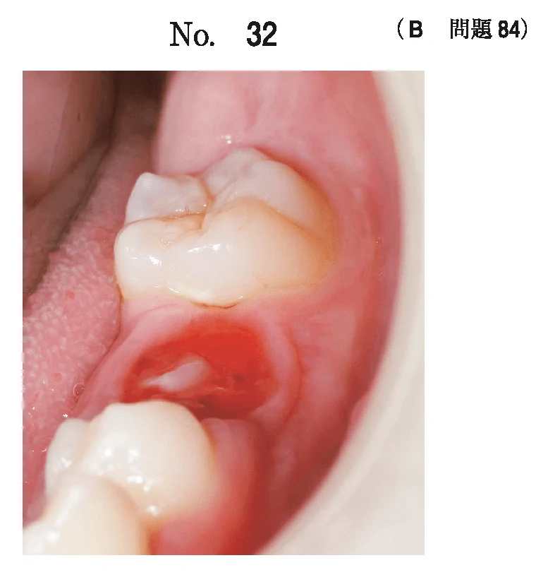 112B84の別冊図1