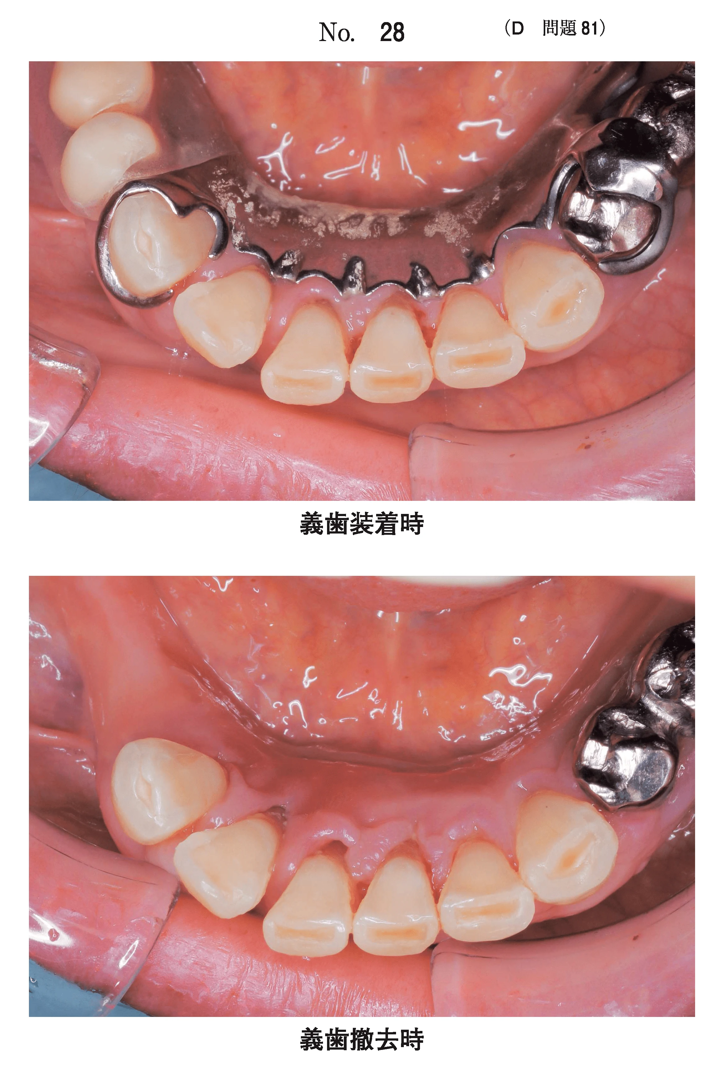 112D81の別冊図1
