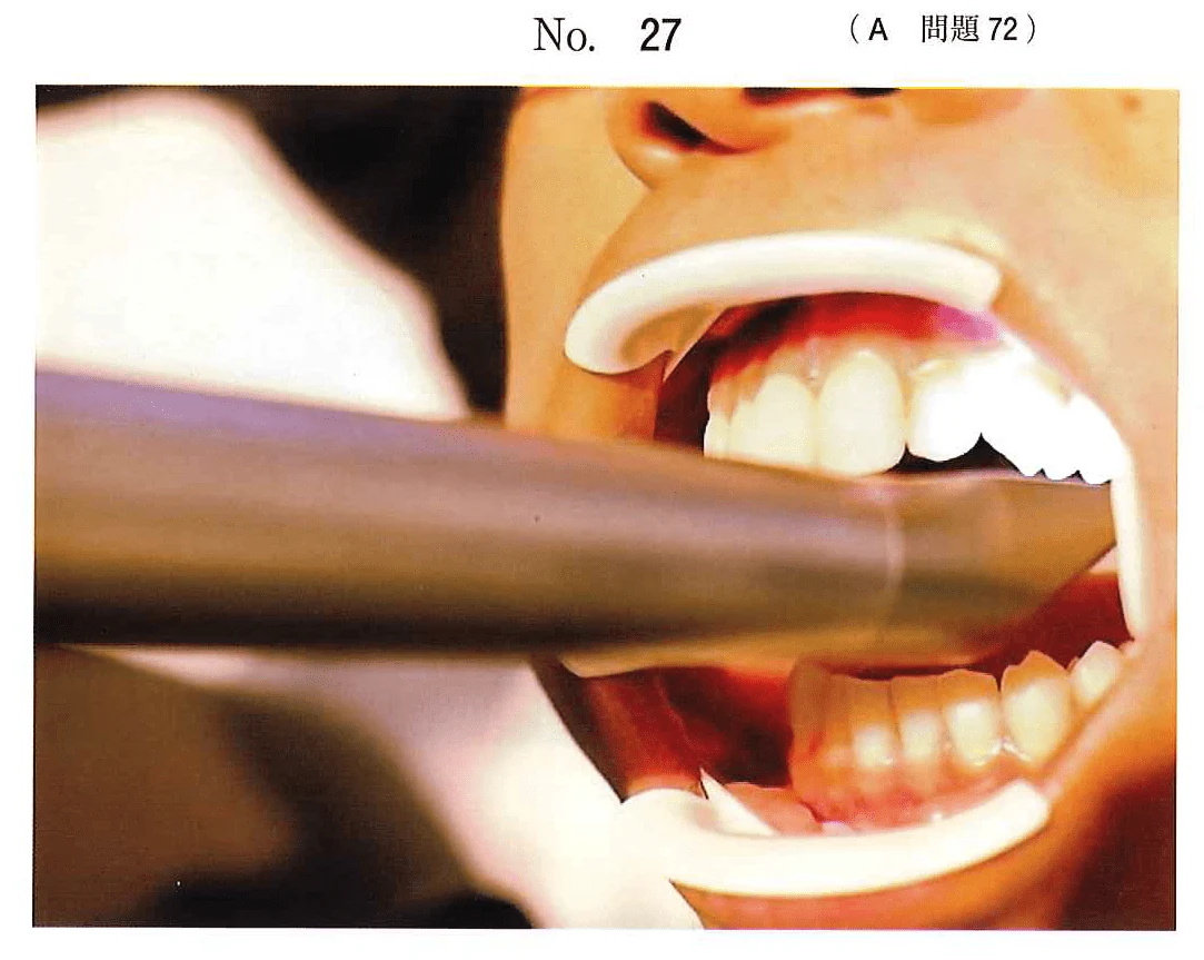 113A72の別冊図1