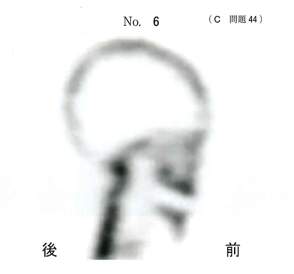 113C44の別冊図1