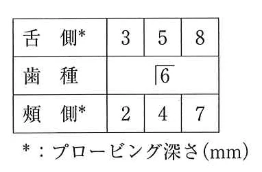 113D51の別冊図2