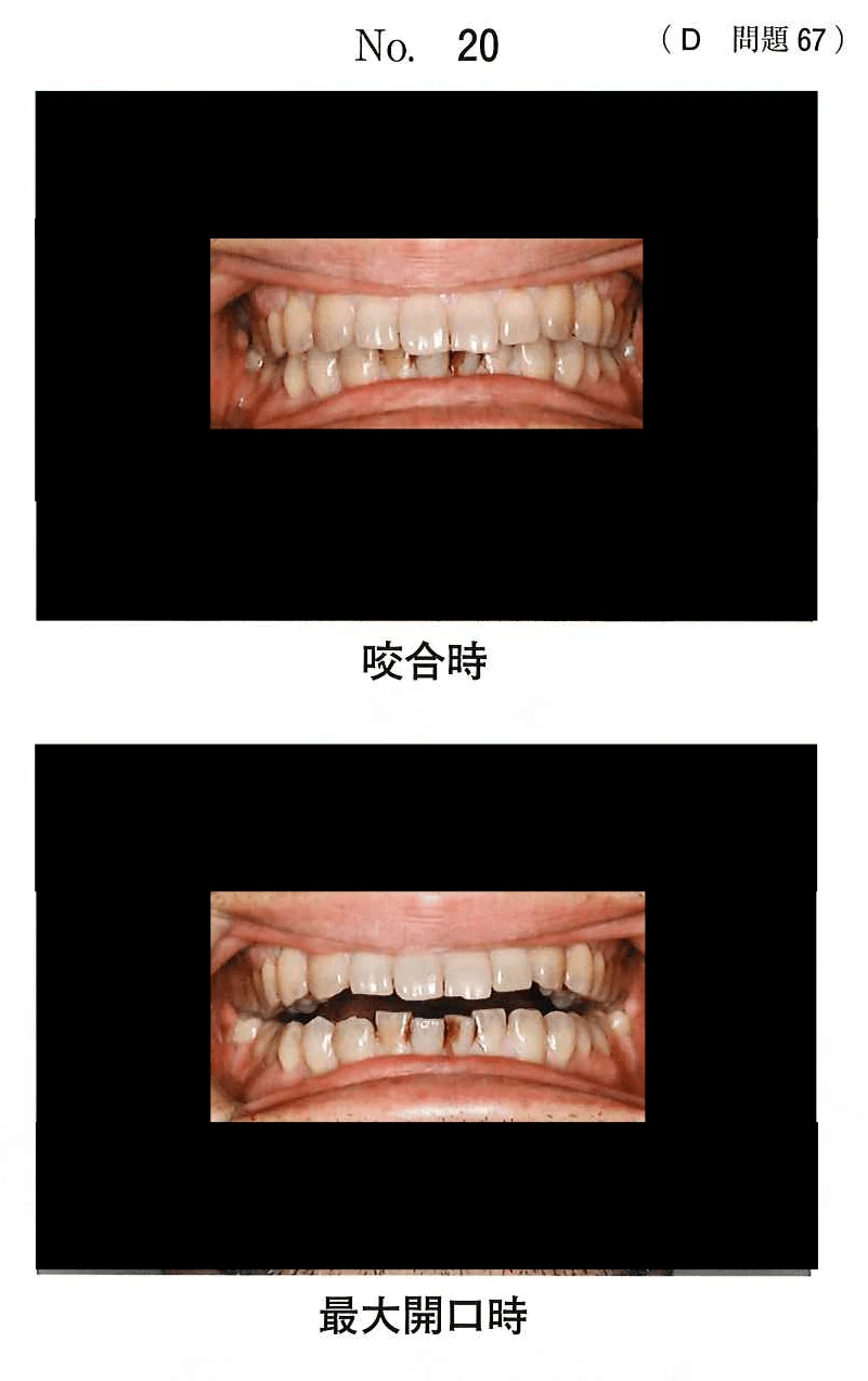 113D67の別冊図1