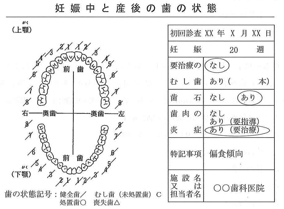 114A74の別冊図2