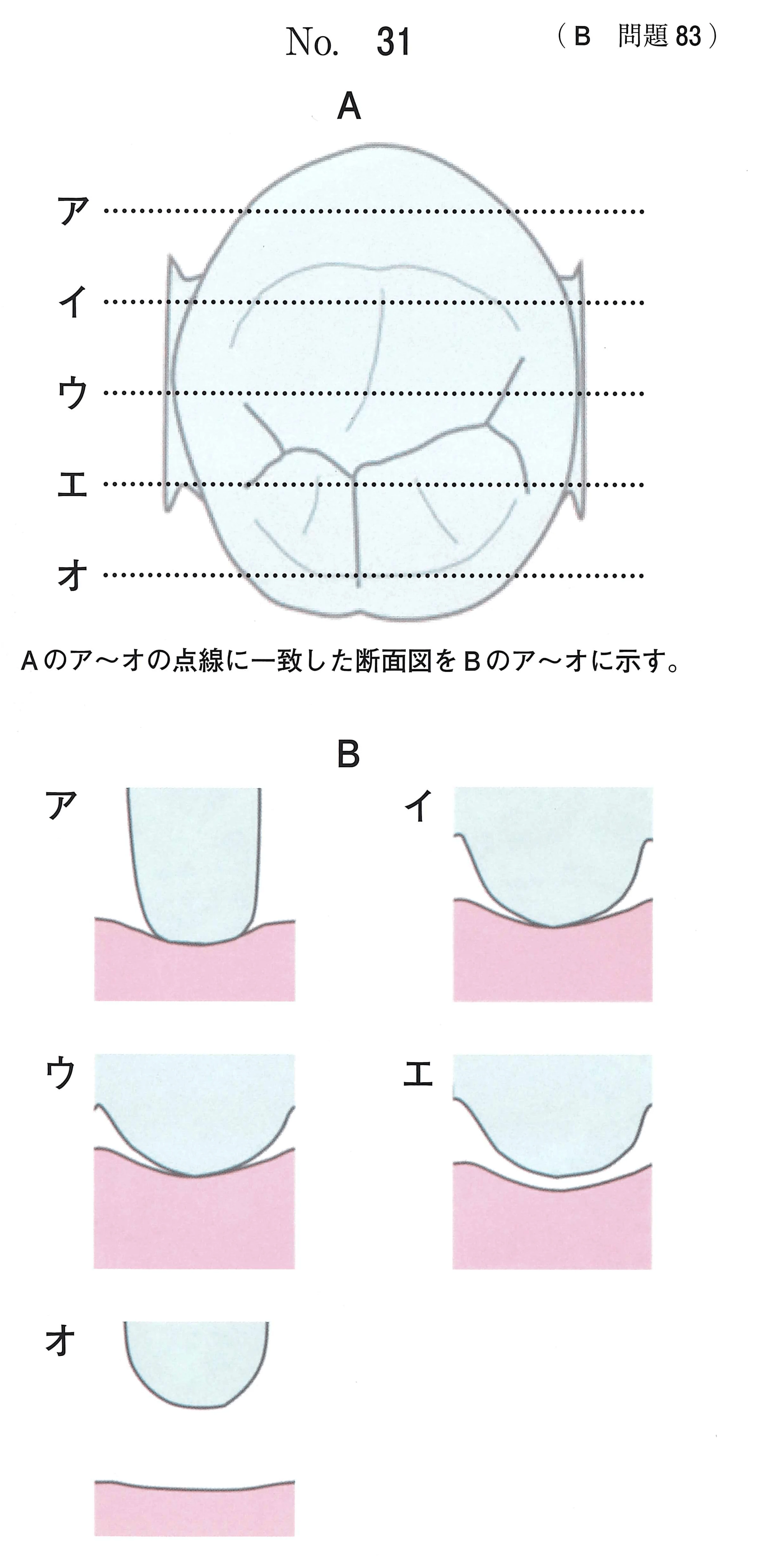 114B83の別冊図1