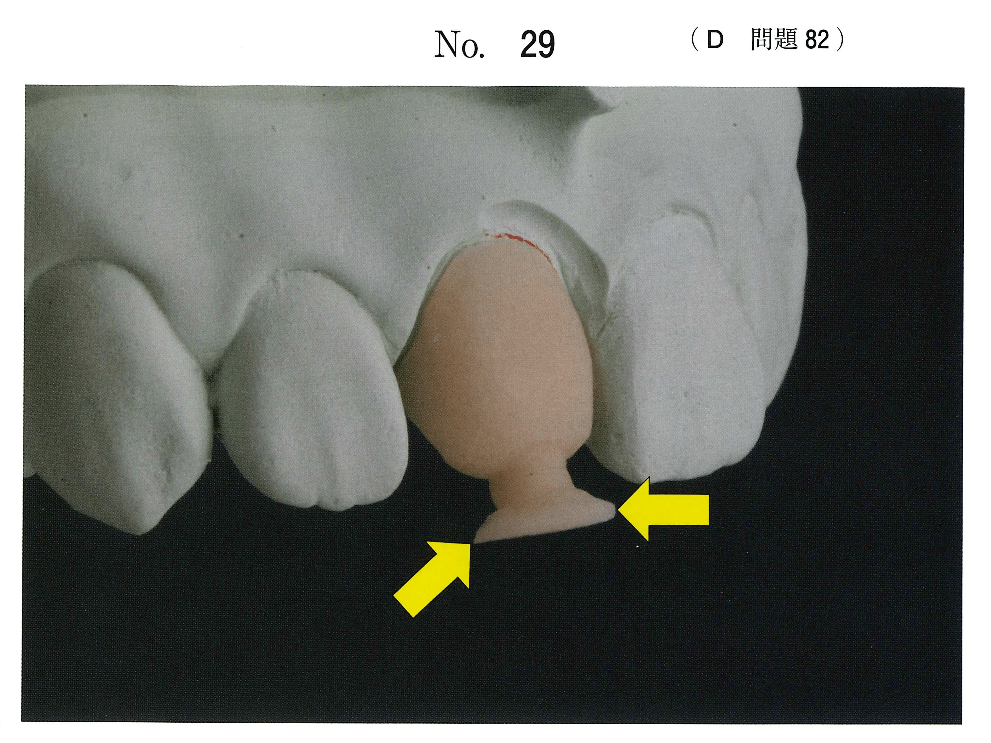 114D82の別冊図1