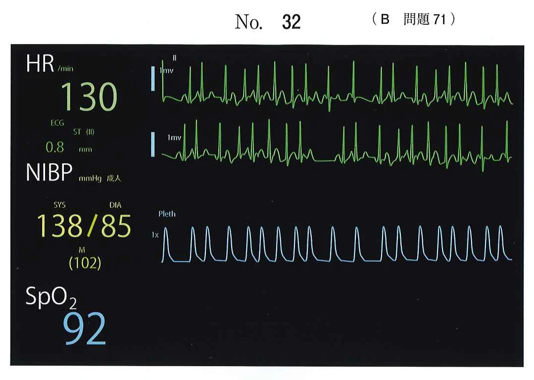 115B71の別冊図1