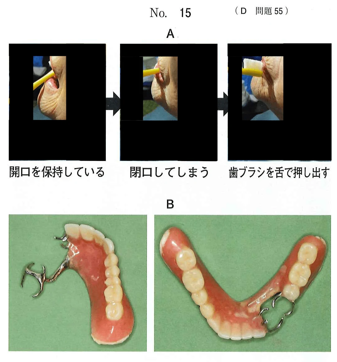 115D55の別冊図1