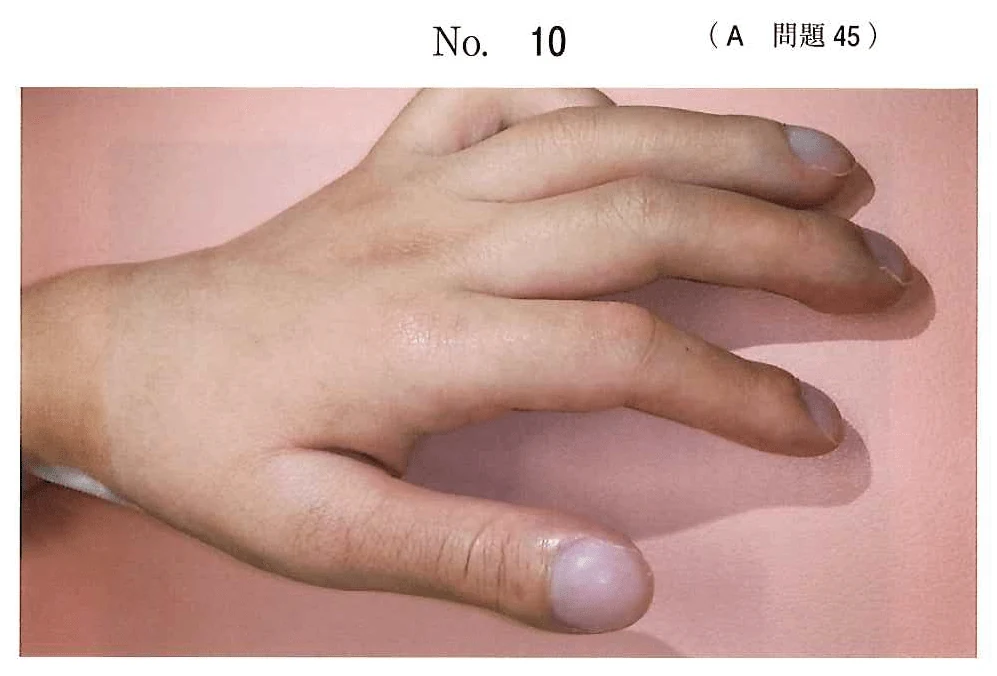 116A45の別冊図1