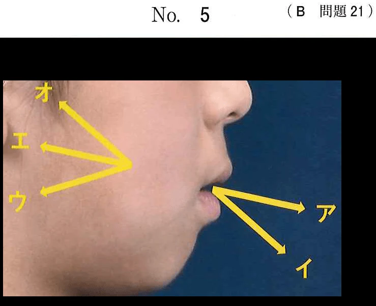 116B21の別冊図1