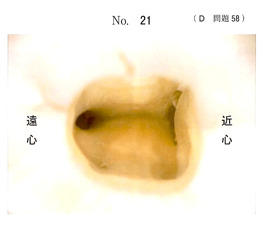 116D58の別冊図1