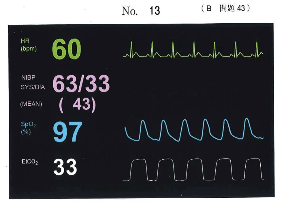 117B43の別冊図1