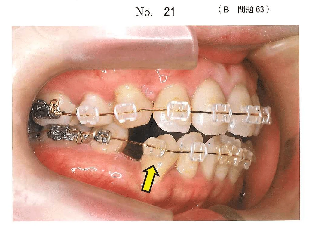 117B63の別冊図1