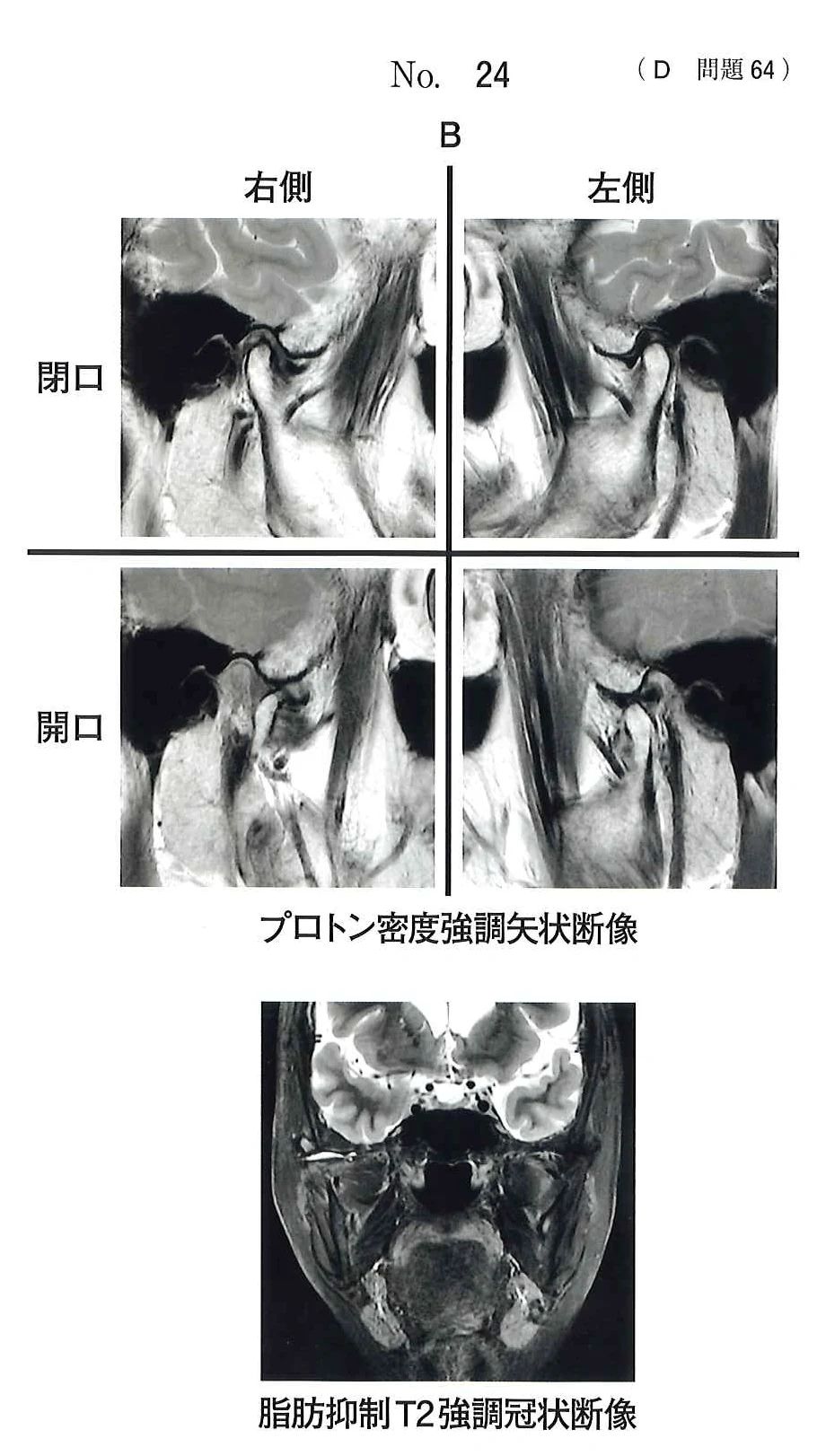 118D64の別冊図2